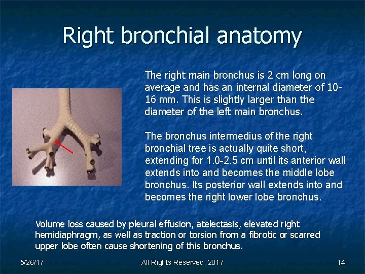Right bronchial anatomy The right main bronchus is 2 cm long on average and