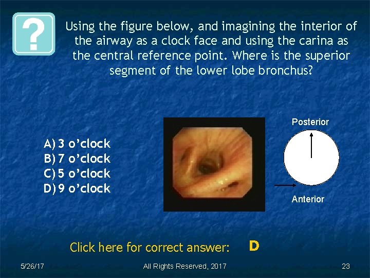 Using the figure below, and imagining the interior of the airway as a clock