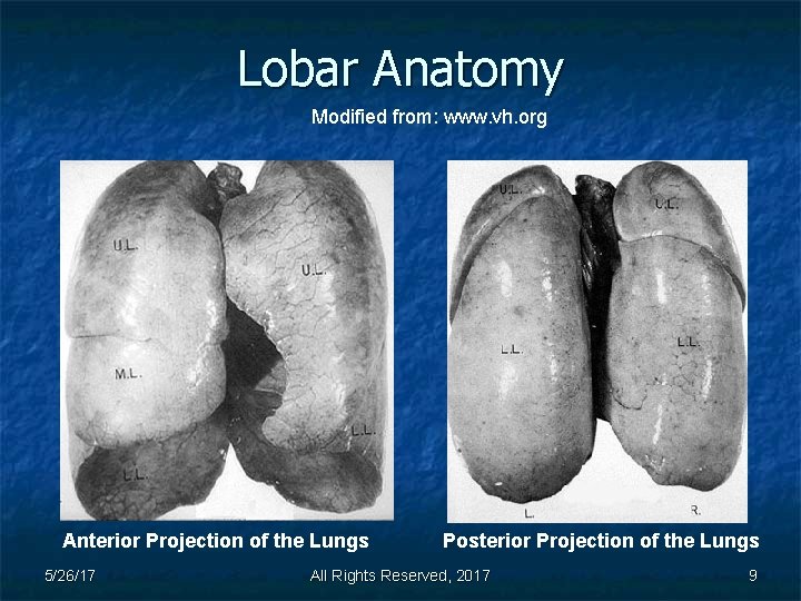 Lobar Anatomy Modified from: www. vh. org Anterior Projection of the Lungs 5/26/17 Posterior