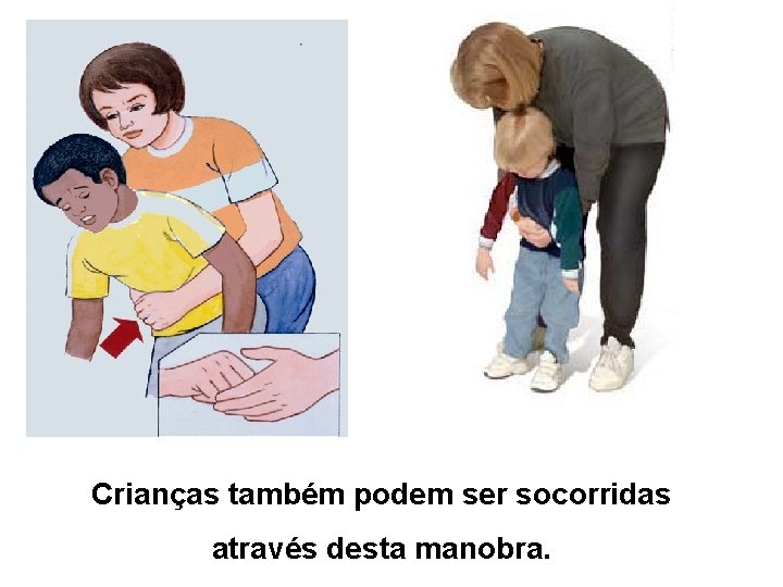 Crianças também podem ser socorridas através desta manobra. 