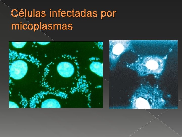 Células infectadas por micoplasmas 