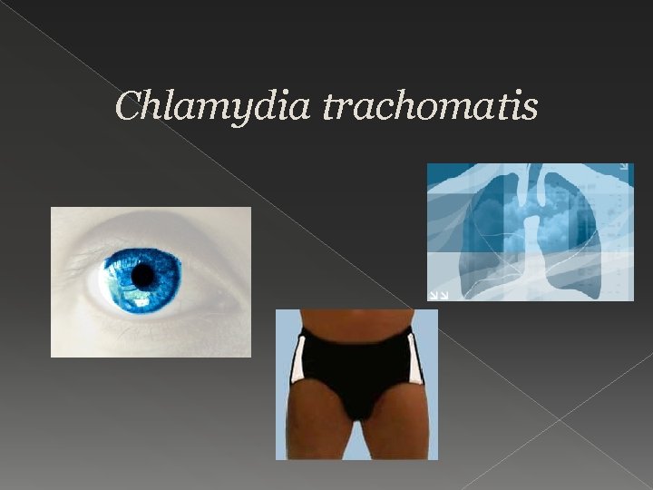 Chlamydia trachomatis 