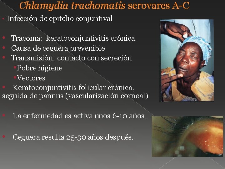 Chlamydia trachomatis serovares A-C • Infección de epitelio conjuntival • • • Tracoma: keratoconjuntivitis