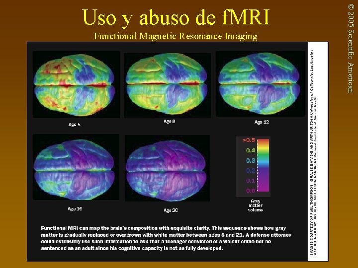 Functional Magnetic Resonance Imaging © 2005 Scientific American Uso y abuso de f. MRI