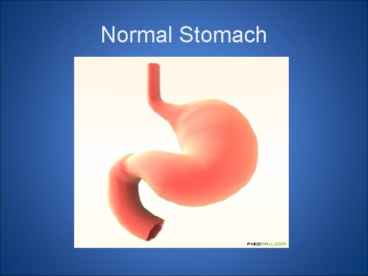 Normal Stomach Normal Stomach
