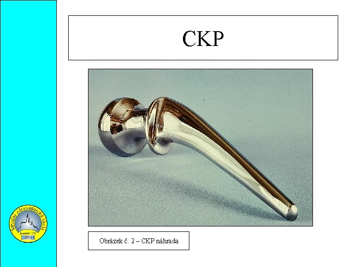 CKP Obrázek č. 2 – CKP náhrada 