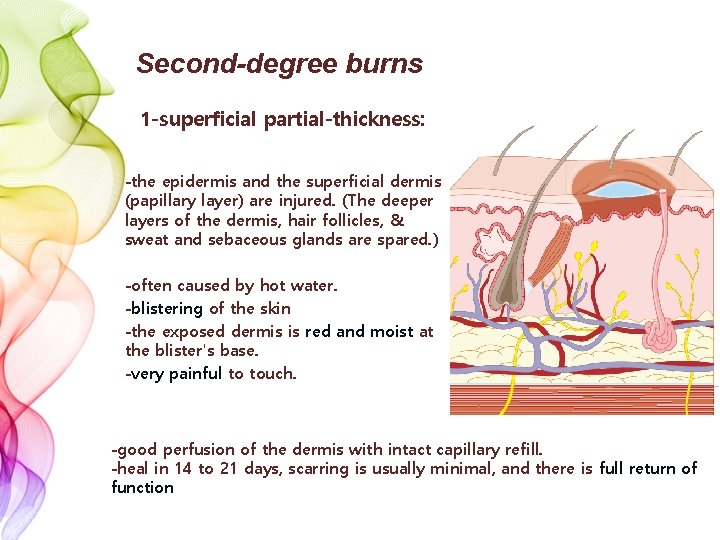 Second-degree burns 1 -superficial partial-thickness: -the epidermis and the superficial dermis (papillary layer) are