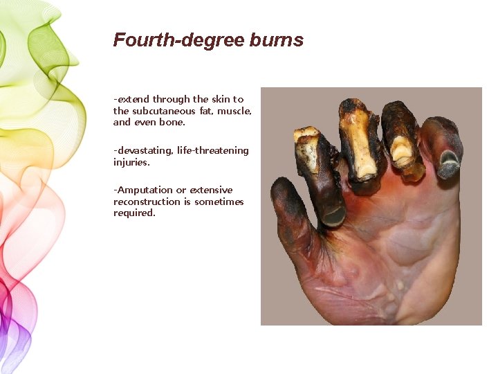 Fourth-degree burns -extend through the skin to the subcutaneous fat, muscle, and even bone.
