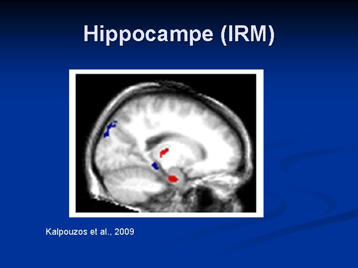 Hippocampe (IRM) Kalpouzos et al. , 2009 Hippocampe (IRM) Kalpouzos et al. , 2009