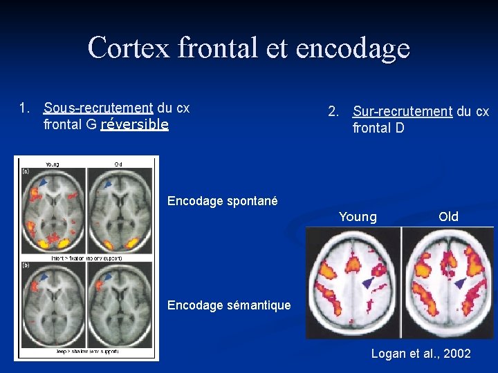 Cortex frontal et encodage 1. Sous-recrutement du cx frontal G réversible 2. Sur-recrutement du Cortex frontal et encodage 1. Sous-recrutement du cx frontal G réversible 2. Sur-recrutement du