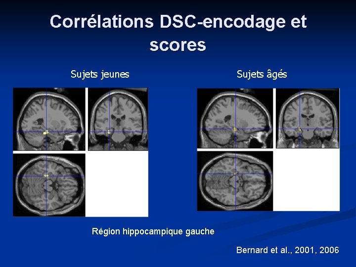 Corrélations DSC-encodage et scores Sujets jeunes Sujets âgés Région hippocampique gauche Bernard et al. Corrélations DSC-encodage et scores Sujets jeunes Sujets âgés Région hippocampique gauche Bernard et al.