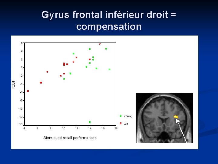 Gyrus frontal inférieur droit = compensation Gyrus frontal inférieur droit = compensation