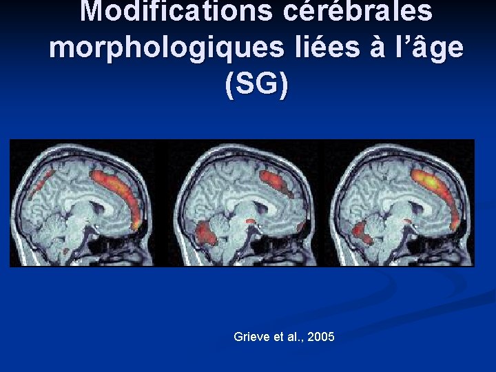 Modifications cérébrales morphologiques liées à l’âge (SG) Grieve et al. , 2005 Modifications cérébrales morphologiques liées à l’âge (SG) Grieve et al. , 2005