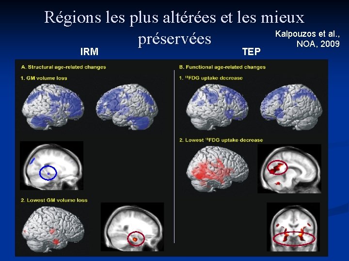 Régions les plus altérées et les mieux Kalpouzos et al. , préservées NOA, 2009 Régions les plus altérées et les mieux Kalpouzos et al. , préservées NOA, 2009