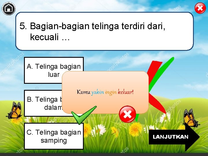 5. Bagian-bagian telinga terdiri dari, kecuali … A. Telinga bagian luar Kamu yakin ingin