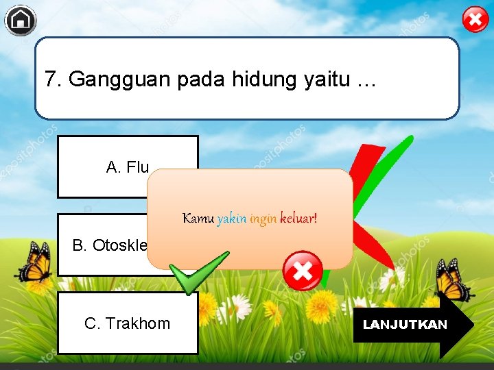 7. Gangguan pada hidung yaitu … A. Flu Kamu yakin ingin keluar! B. Otosklerosis