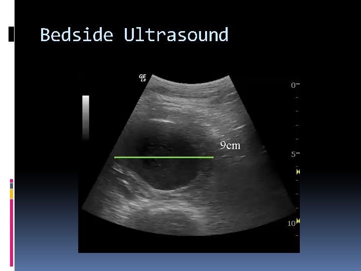 Bedside Ultrasound 9 cm 