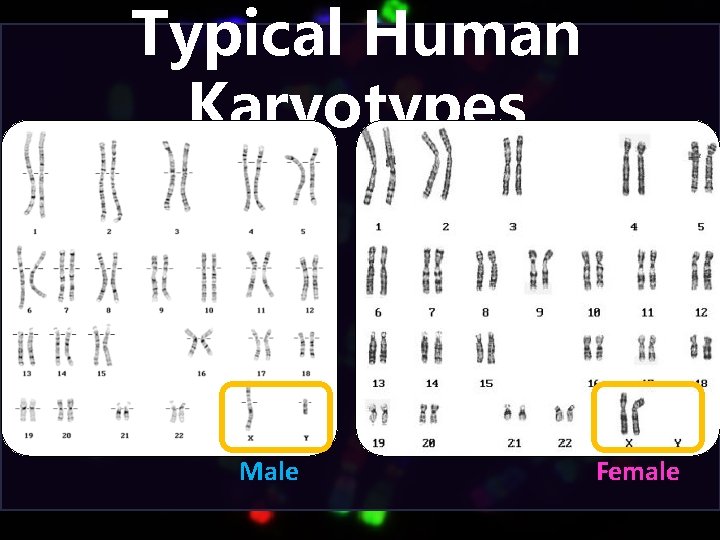 Typical Human Karyotypes Male Female 