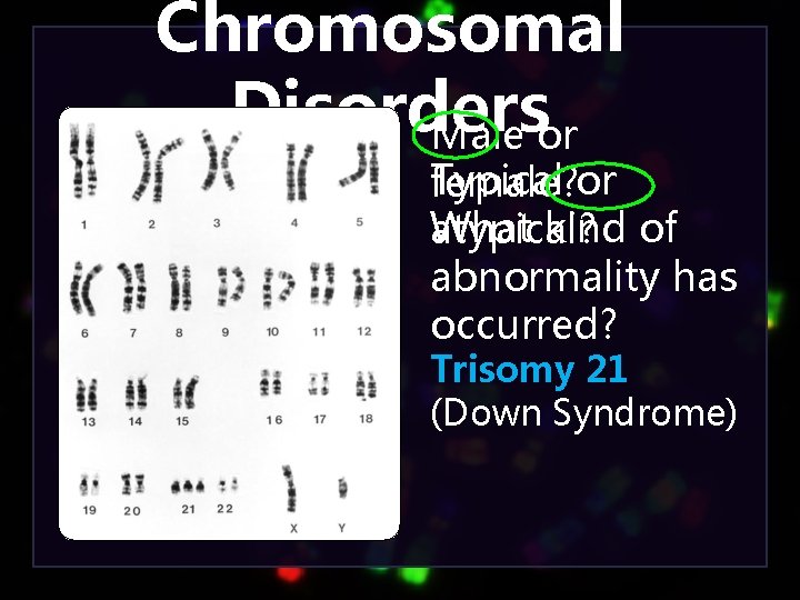 Chromosomal Disorders Male or Typical female? or What kind of atypical? abnormality has occurred?