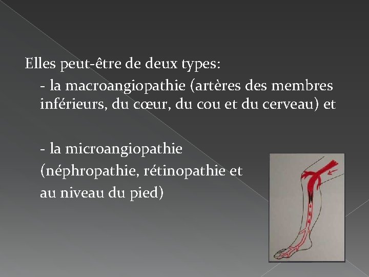 Elles peut-être de deux types: - la macroangiopathie (artères des membres inférieurs, du cœur,