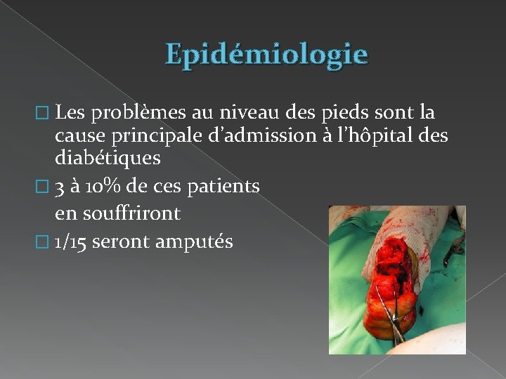 Epidémiologie � Les problèmes au niveau des pieds sont la cause principale d’admission à