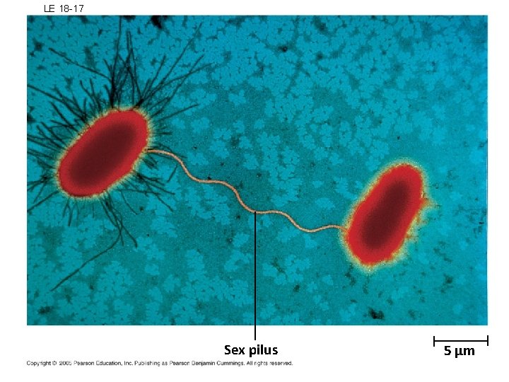LE 18 -17 Sex pilus 5 µm 