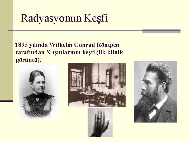 Radyasyonun Keşfi 1895 yılında Wilhelm Conrad Röntgen tarafından X-ışınlarının keşfi (ilk klinik görüntü), 