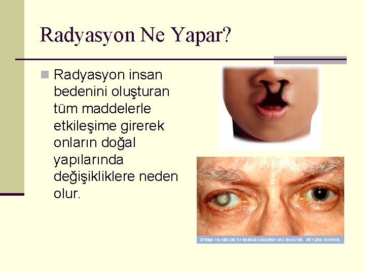 Radyasyon Ne Yapar? n Radyasyon insan bedenini oluşturan tüm maddelerle etkileşime girerek onların doğal