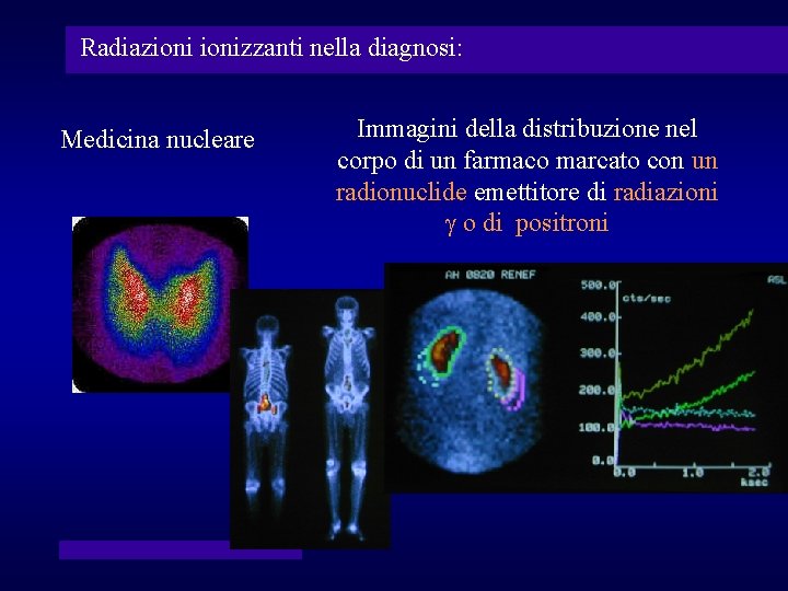 Radiazionizzanti nella diagnosi: Medicina nucleare Immagini della distribuzione nel corpo di un farmaco marcato