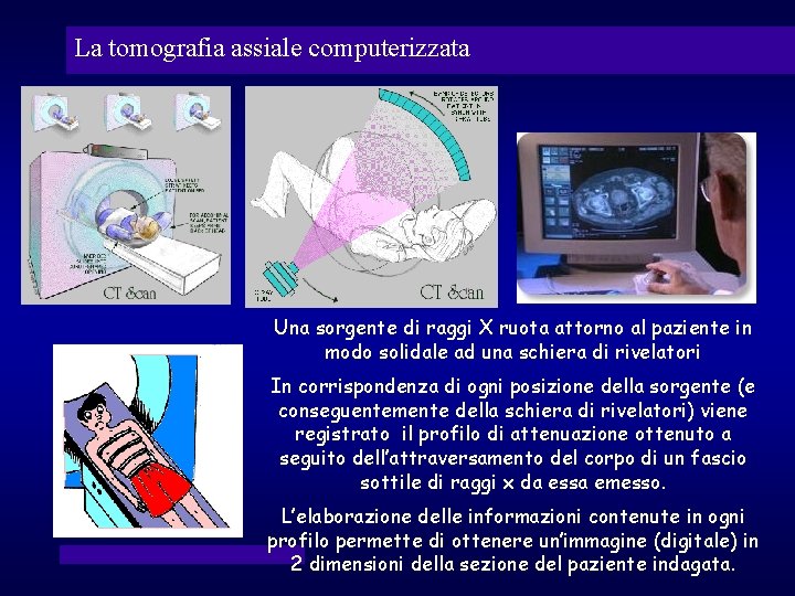 La tomografia assiale computerizzata Una sorgente di raggi X ruota attorno al paziente in