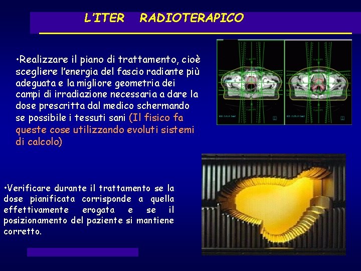 L’ITER RADIOTERAPICO • Realizzare il piano di trattamento, cioè scegliere l’energia del fascio radiante