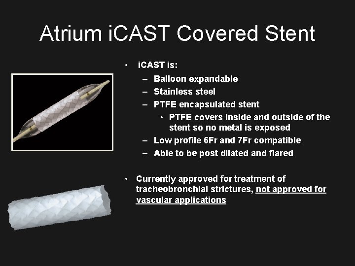 Atrium i. CAST Covered Stent • i. CAST is: – Balloon expandable – Stainless