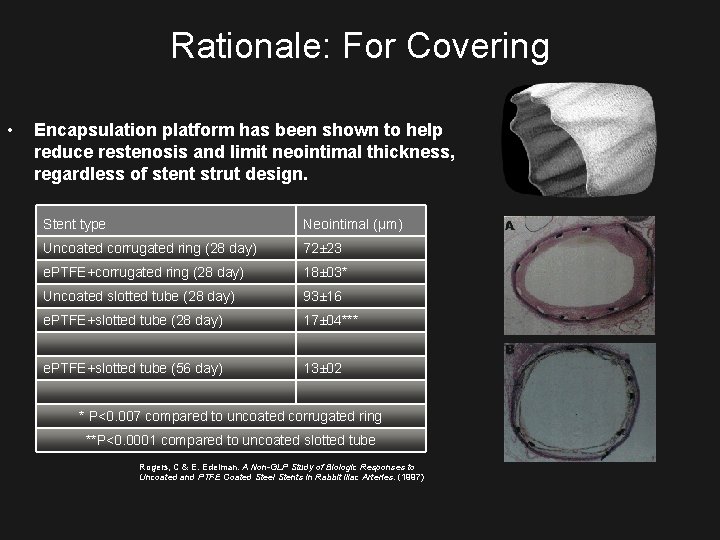 Rationale: For Covering • Encapsulation platform has been shown to help reduce restenosis and