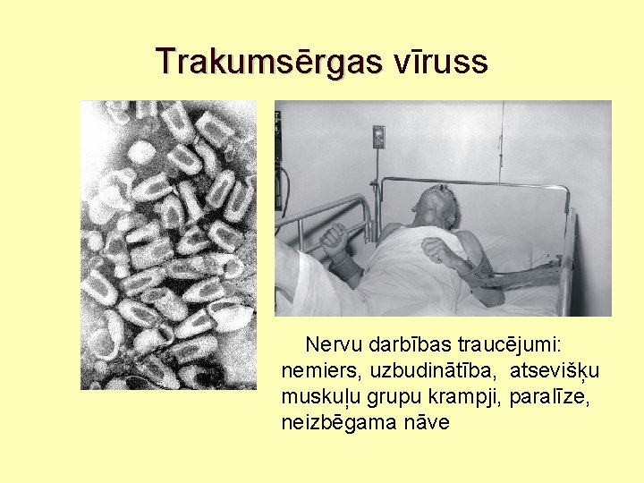 Trakumsērgas vīruss Nervu darbības traucējumi: nemiers, uzbudinātība, atsevišķu muskuļu grupu krampji, paralīze, neizbēgama nāve
