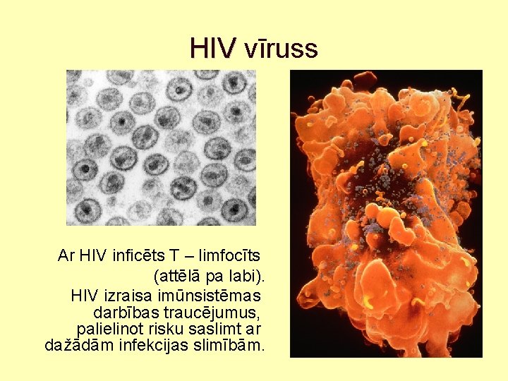 HIV vīruss Ar HIV inficēts T – limfocīts (attēlā pa labi). HIV izraisa imūnsistēmas