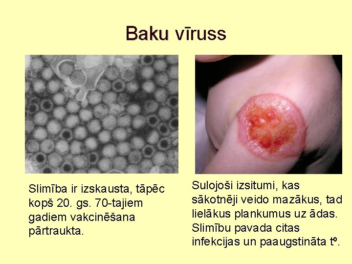 Baku vīruss Slimība ir izskausta, tāpēc kopš 20. gs. 70 -tajiem gadiem vakcinēšana pārtraukta.