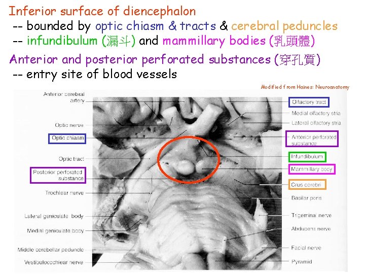 Inferior surface of diencephalon -- bounded by optic chiasm & tracts & cerebral peduncles
