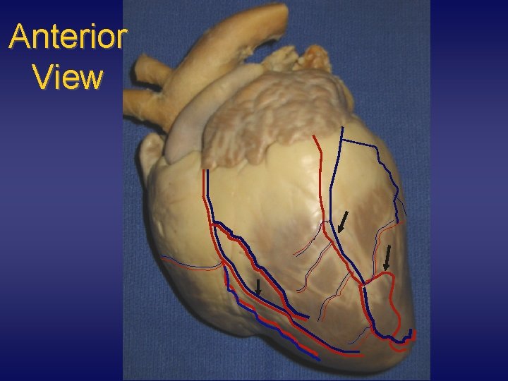 Anterior View 