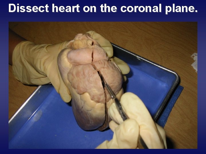 Dissect heart on the coronal plane. 