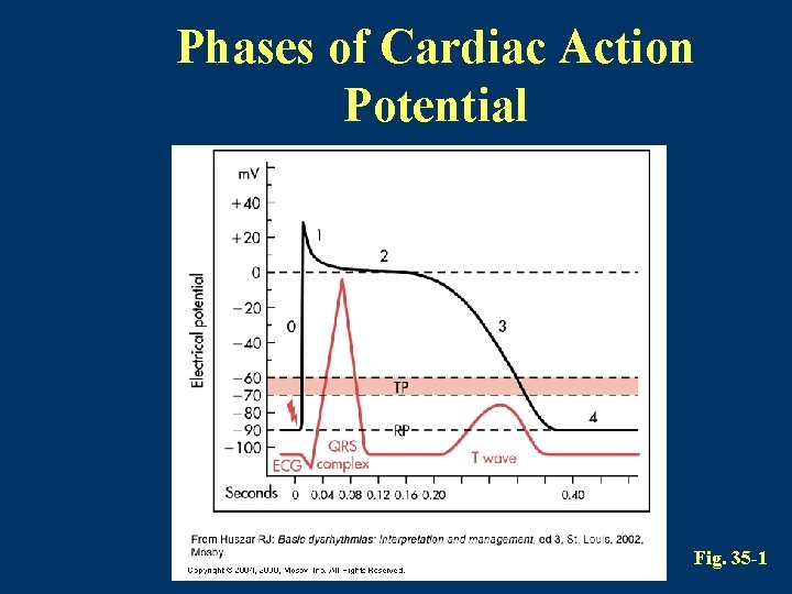 Phases of Cardiac Action Potential Fig. 35 -1 