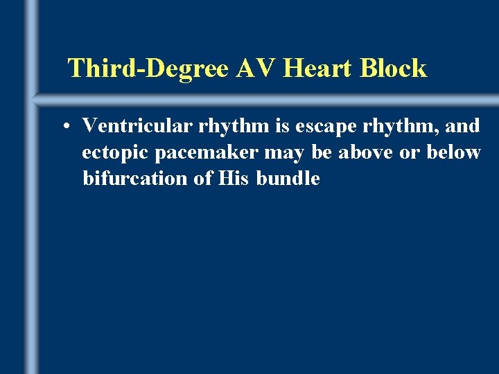 Third-Degree AV Heart Block • Ventricular rhythm is escape rhythm, and ectopic pacemaker may