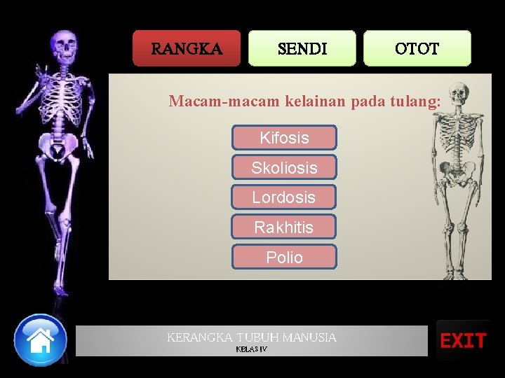 RANGKA SENDI OTOT Macam-macam kelainan pada tulang: Kifosis Skoliosis Lordosis Rakhitis Polio KERANGKA TUBUH