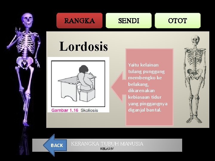 RANGKA SENDI OTOT Lordosis Yaitu kelainan tulang punggung membengko ke belakang, dikarenakan kebiasaan tidur