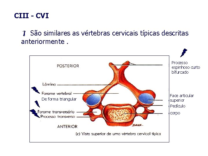 CIII - CVI São similares as vértebras cervicais típicas descritas anteriormente. Processo espinhoso curto