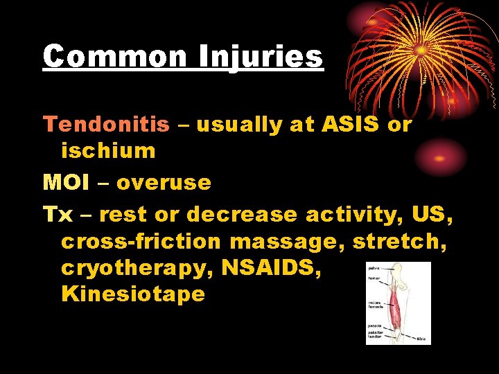 Common Injuries Tendonitis – usually at ASIS or ischium MOI – overuse Tx –