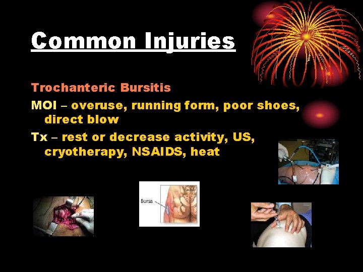 Common Injuries Trochanteric Bursitis MOI – overuse, running form, poor shoes, direct blow Tx