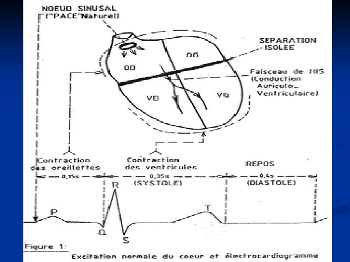 TROUBLES DU RYTHME ET DE LA CONDUCTION ECG