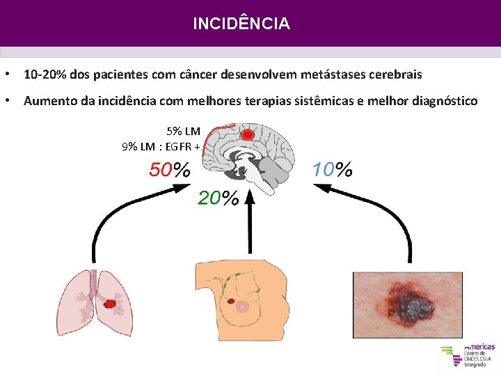 INCIDÊNCIA • 10 -20% dos pacientes com câncer desenvolvem metástases cerebrais • Aumento da