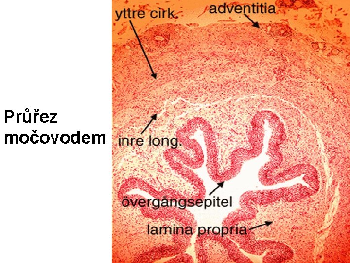 Průřez močovodem 