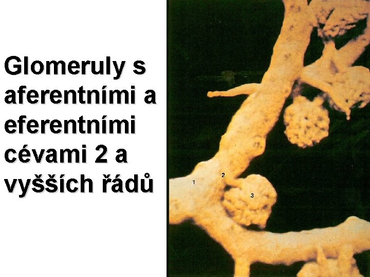 Glomeruly s aferentními a eferentními cévami 2 a vyšších řádů 